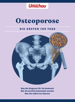 Osteoporose Die ersten 100 Tage